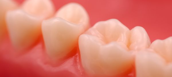 オールジルコニアクラウン