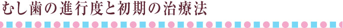 むし歯の進行度と初期の治療法