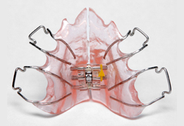 マウスピース矯正装置イメージ