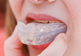 マウスピース矯正装置イメージ